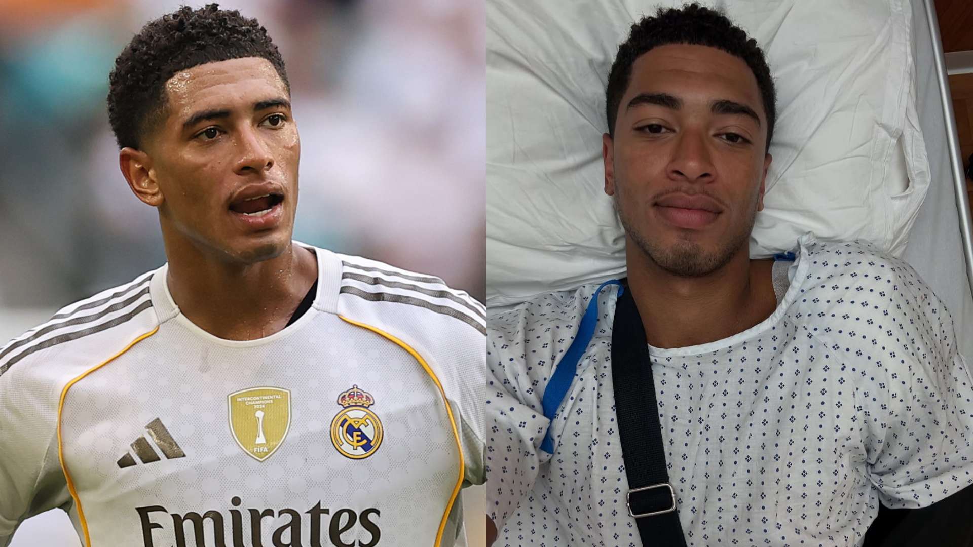 Jude Bellingham shoulder surgery 2025