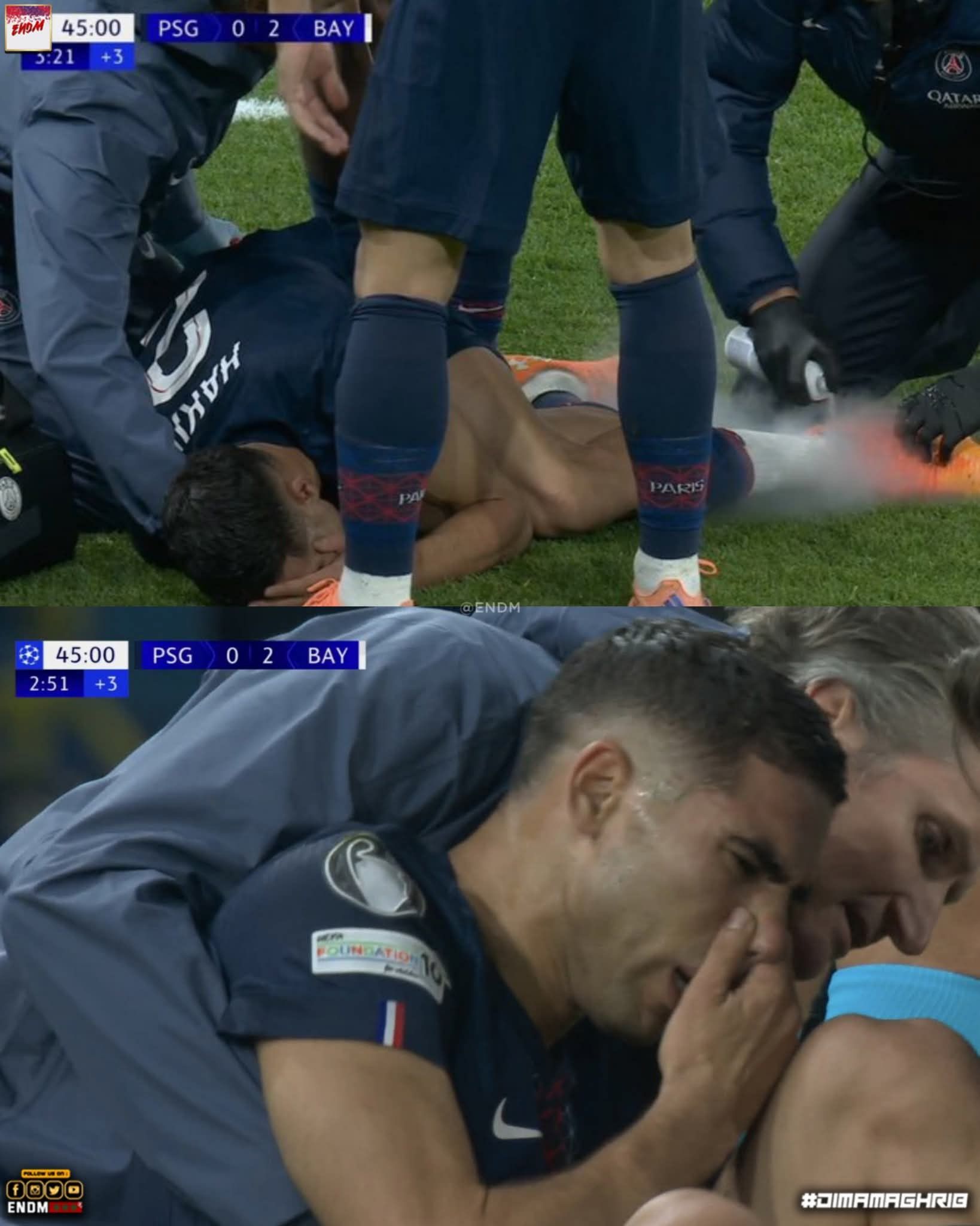 إصابة حكيمي 3