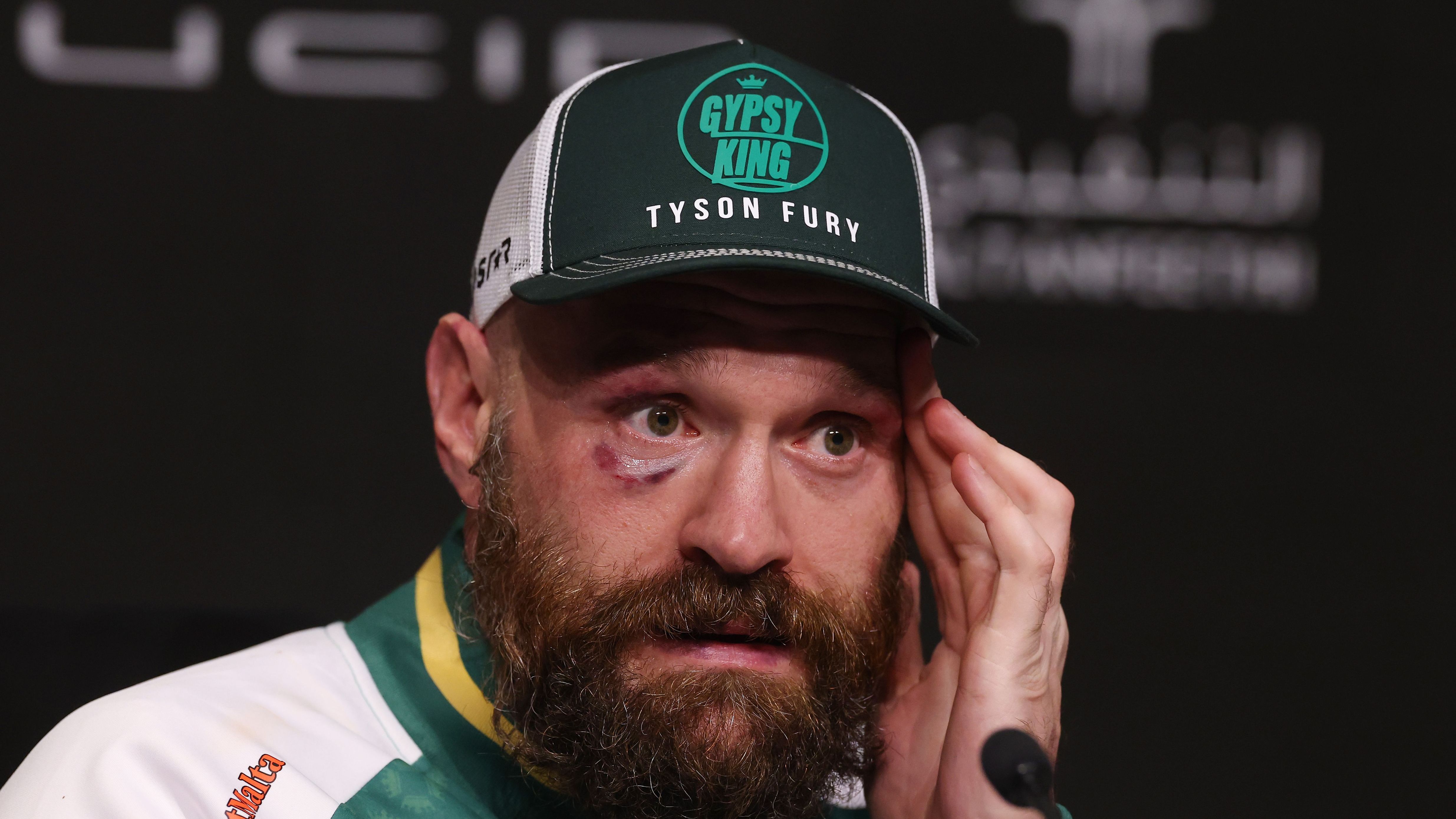 Oleksandr Usyk v Tyson Fury 2 - Fight Night