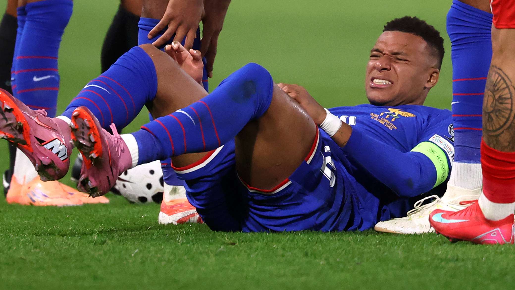 إصابة مبابي