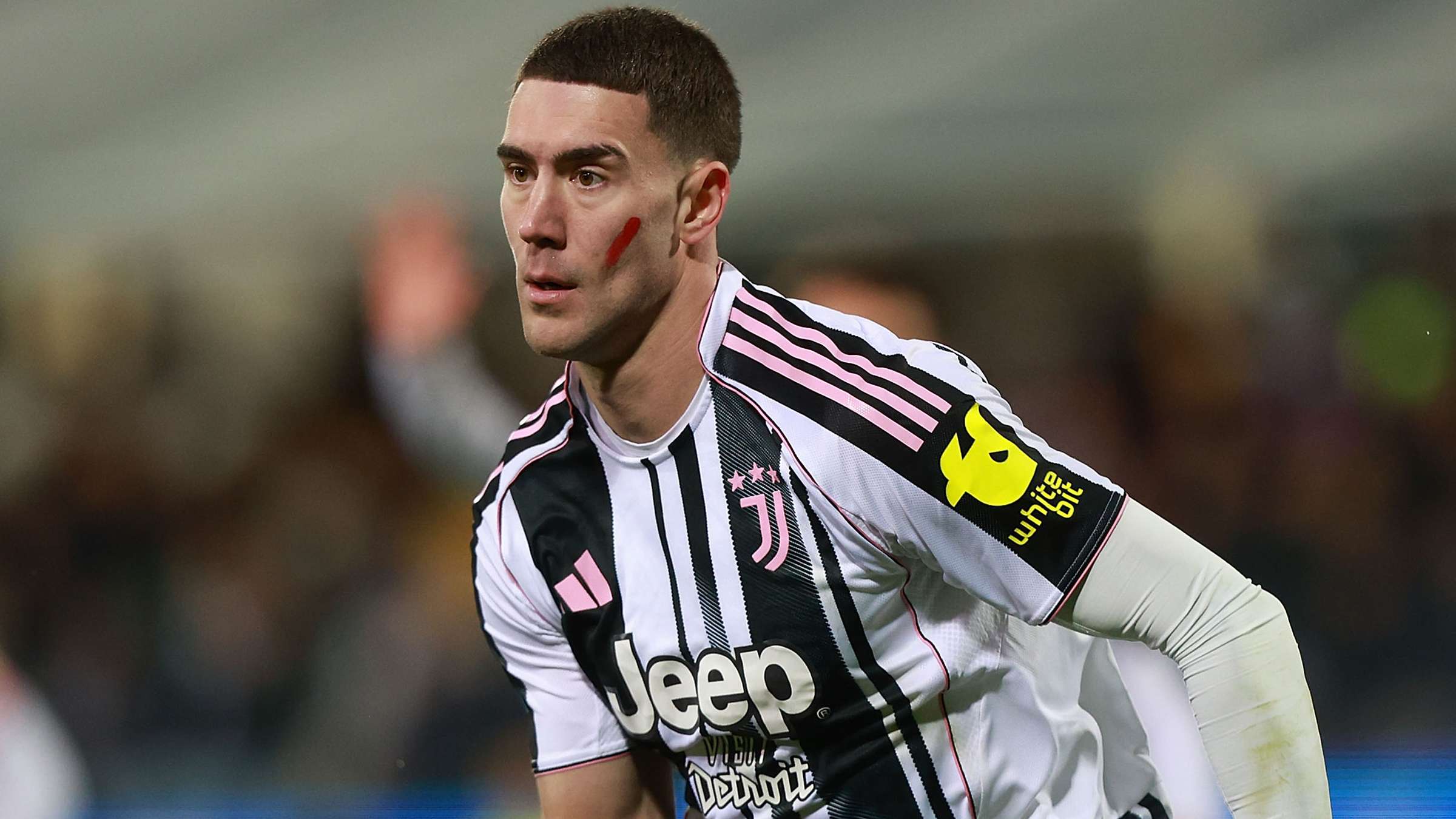 ACF Fiorentina v Juventus FC - Serie A