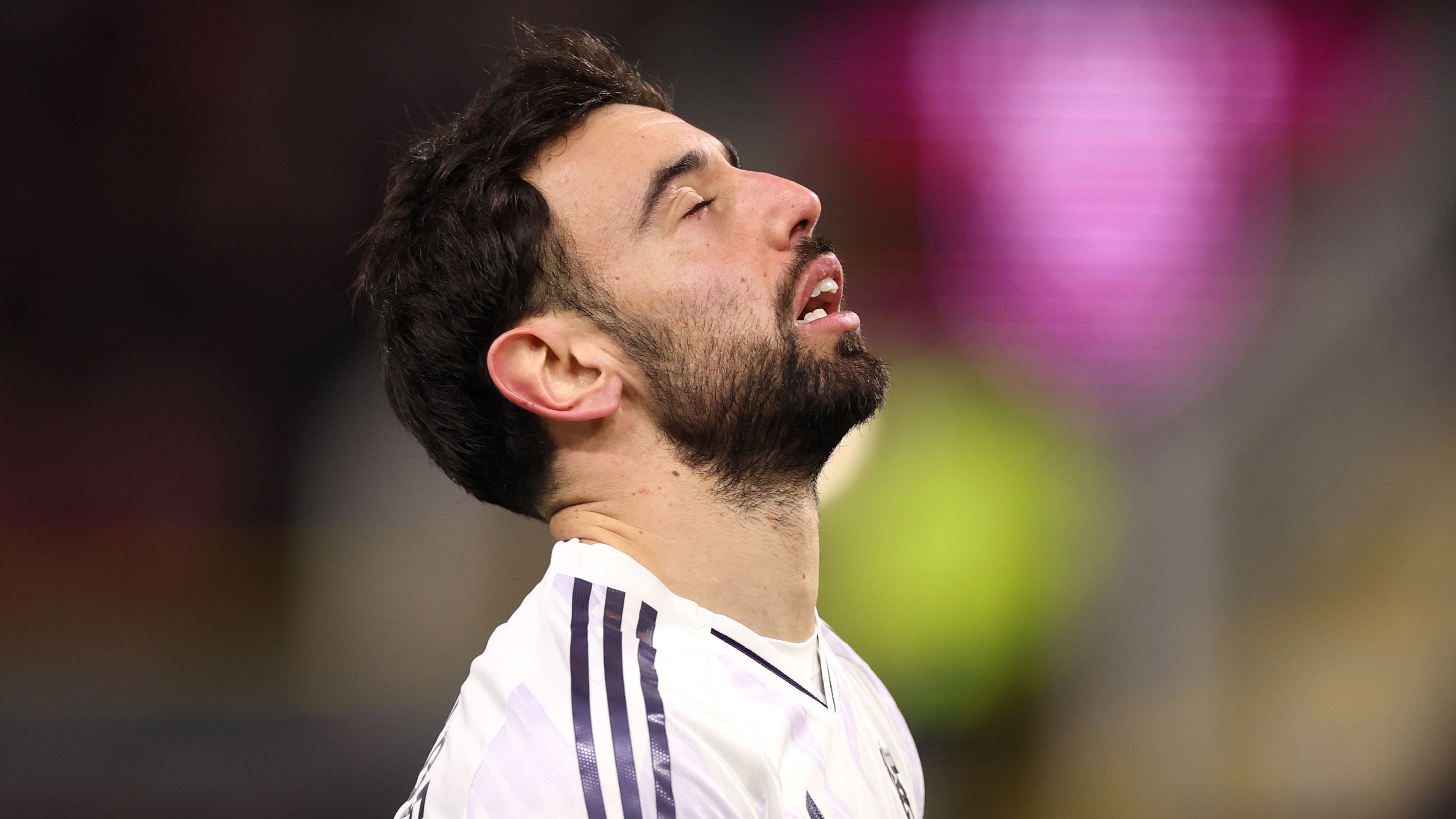 Burnley v Manchester United - Premier League