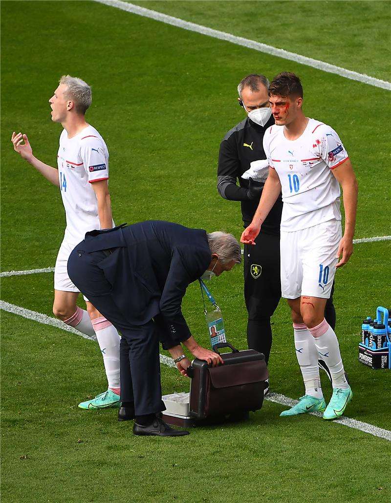 باتريك تشيك