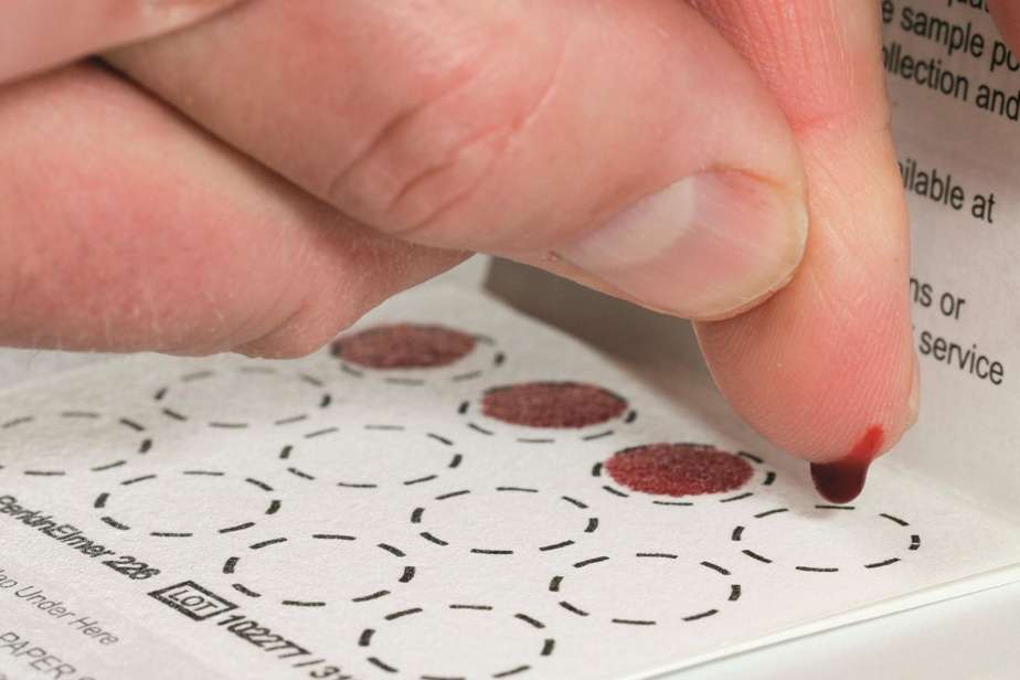 عينات الدم المجففة