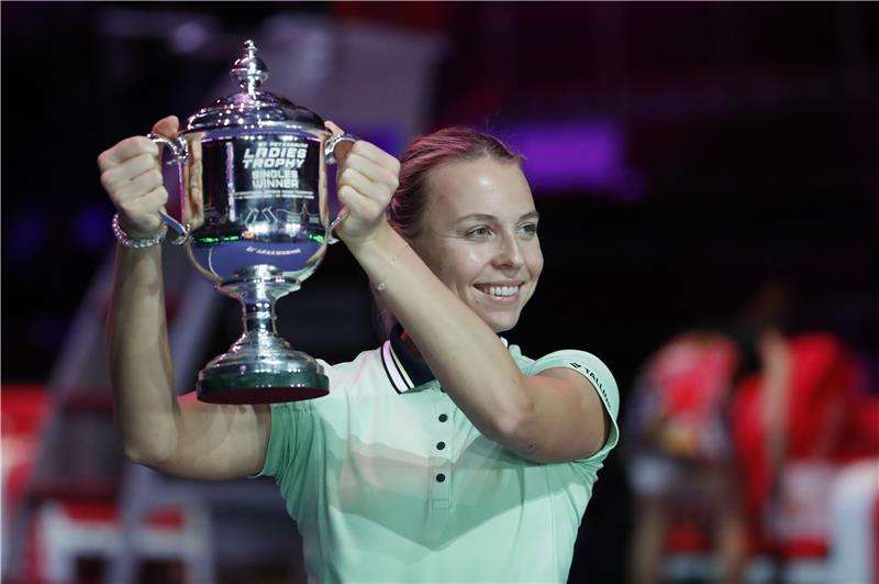 أنيت كونتافيت