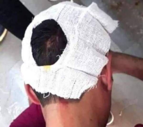 جانب من الأحداث