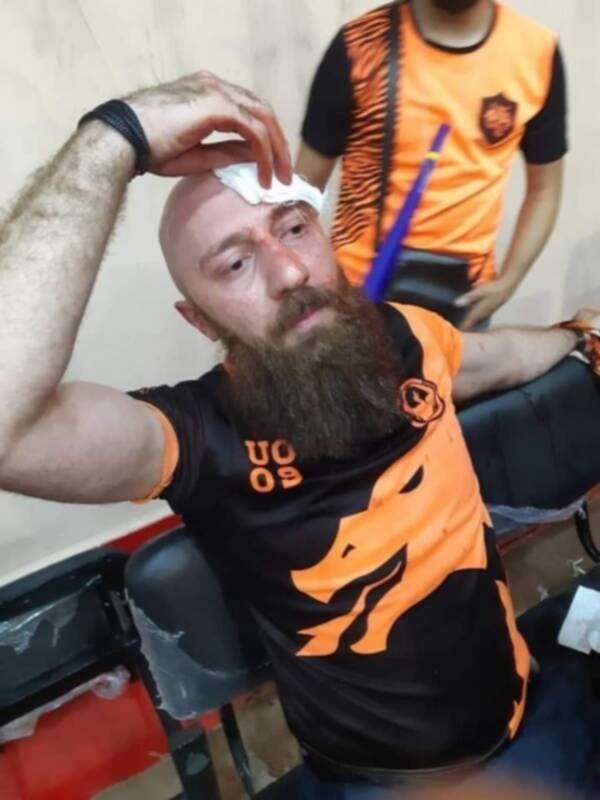 إصابات نتيجة أحداث الشغب