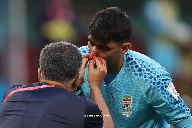 ?i=afp%2f20221121%2f20221121-afp_32pf9r8_afp