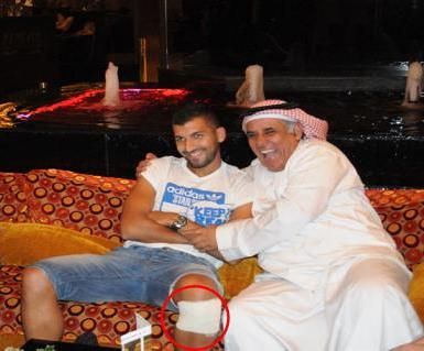 رباط ابيض وضعه اللاعب بعد انتهائه من مشاركة منتخب بلاده وتم اكتشاف الإصابة  