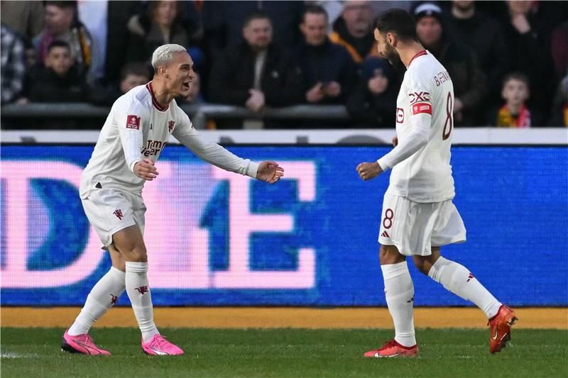 أنتوني وفرنانديز