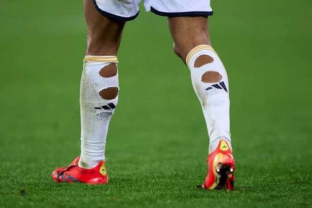 الجوارب الممزقة