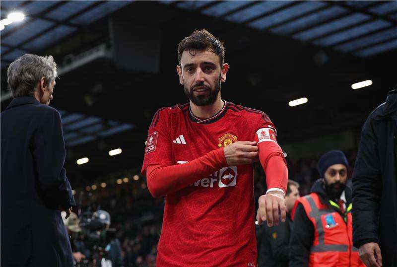 برونو فيرنانديز