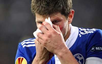 هونتلار يخرج من الملعب بعد تعرضه للإصابة في أنفه