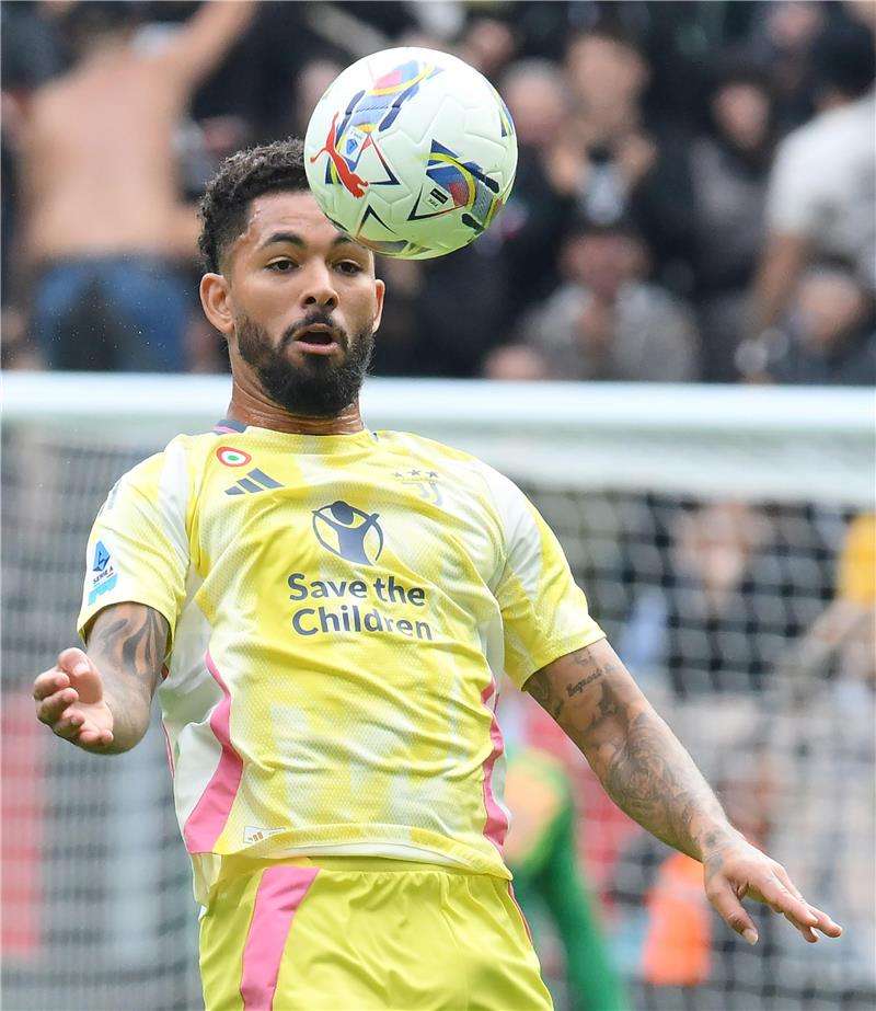 دوجلاس لويز