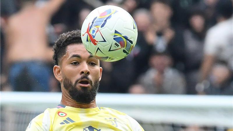 دوجلاس لويز