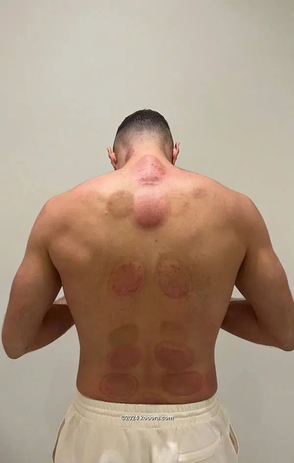 ?i=corr%2f546%2fkoo_546590