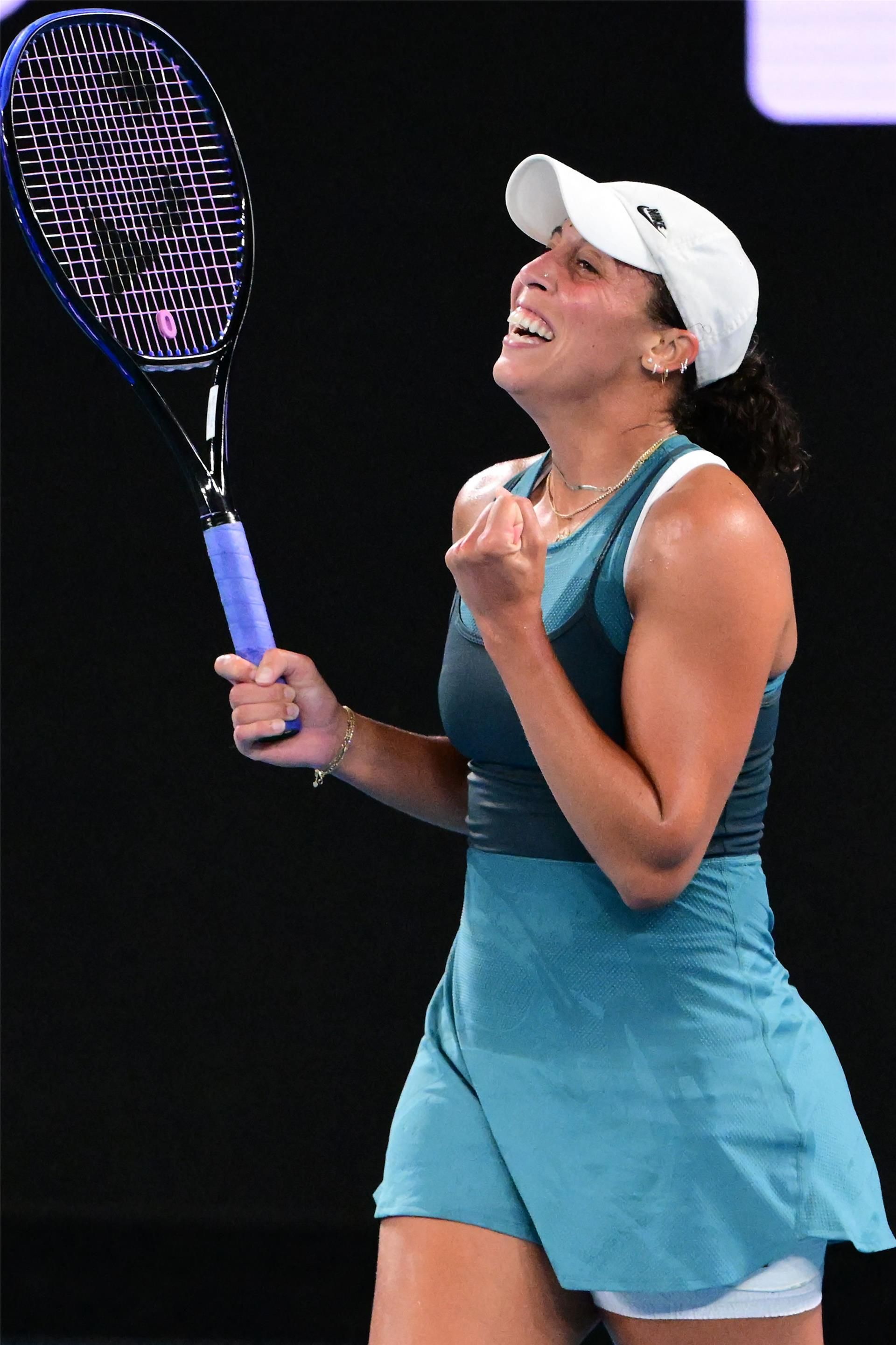 ماديسون كيز