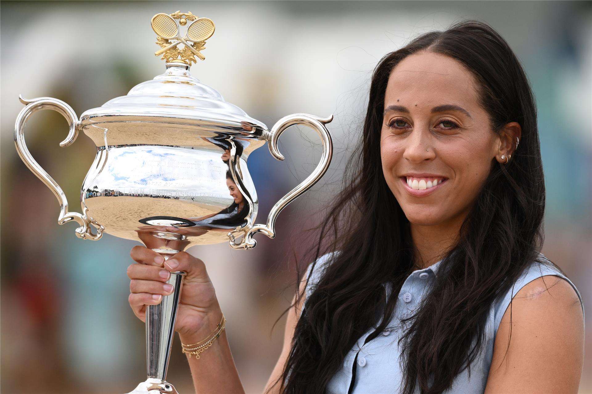 ماديسون كيز