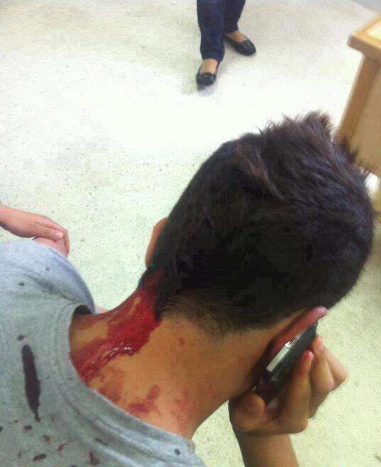 خليل شمام مصاباً في رأسه