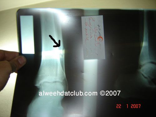 الصورة ماخوذة بالتعاون مع موقع جماهير الوحدات(club)..