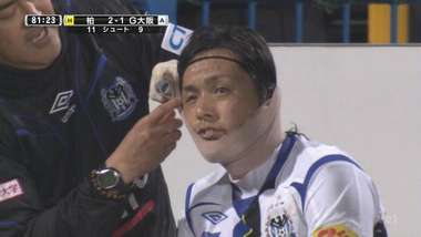 ياسوهيتو إيندو نجح في إكمال المباراة بعد وضع اللاصق الطبي حول رأسه