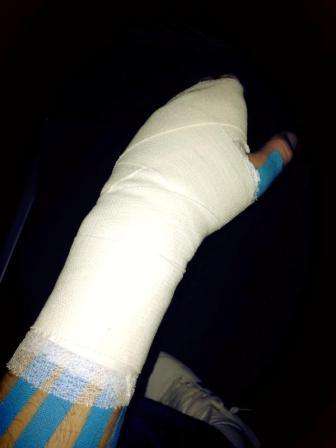 صورة يد كاسياس كما نشرها على صفحته في "فيس بوك"