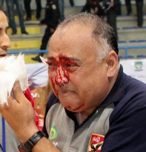 عاصم حماد مصاب بعد الإعتداء عليه