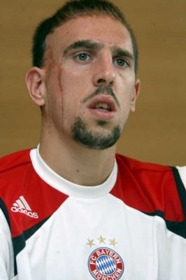 الـفـرنـســي فـرانـــك ريــبــيـــري