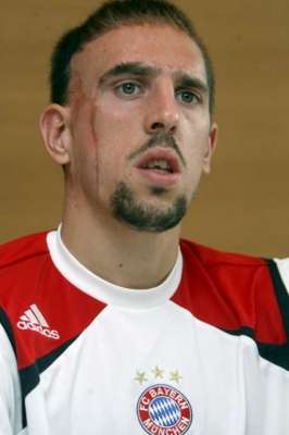 الـفـرنـســي فـرانـــك ريــبــيـــري