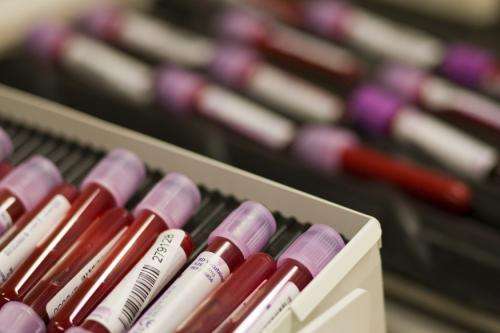 2011-07-19t115644z_01_vfl15_rtridsp_3_olympics-london-doping_reuters