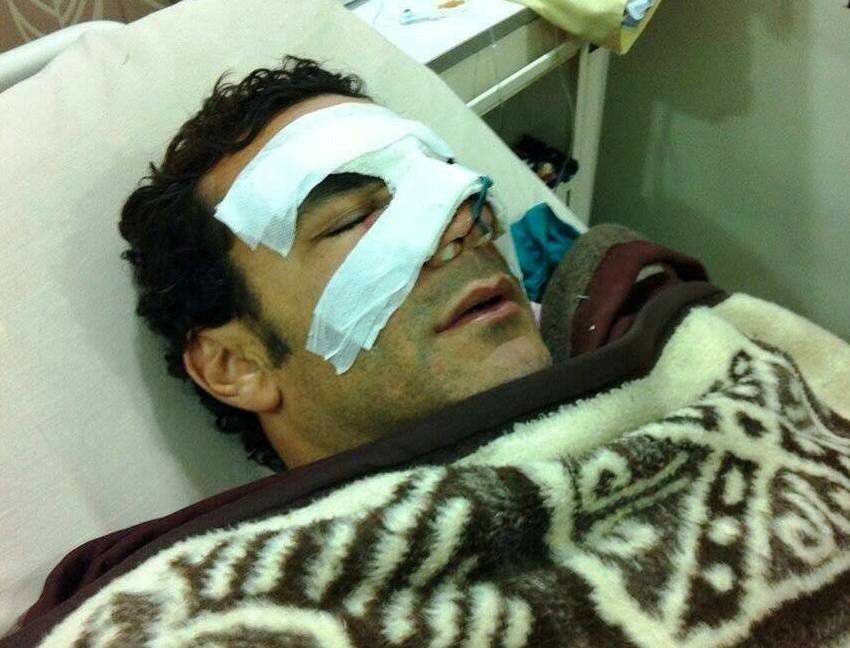 صورة الحضري بعد العملية بالقاهرة