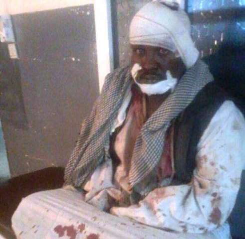 جانب من المصابين في الحادث