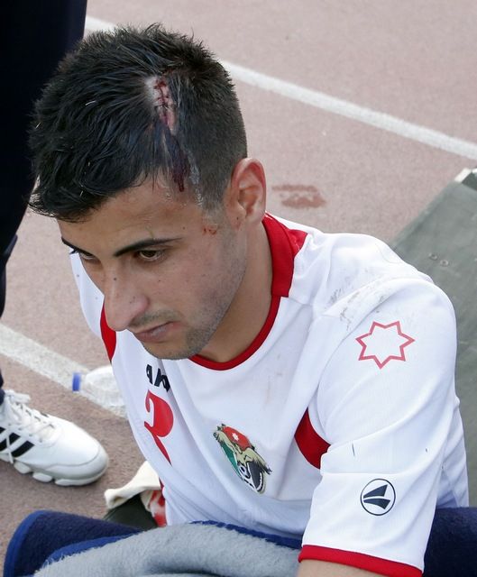 "7" غرز في رأس خطاب   (تصوير: أحمد الأمين)