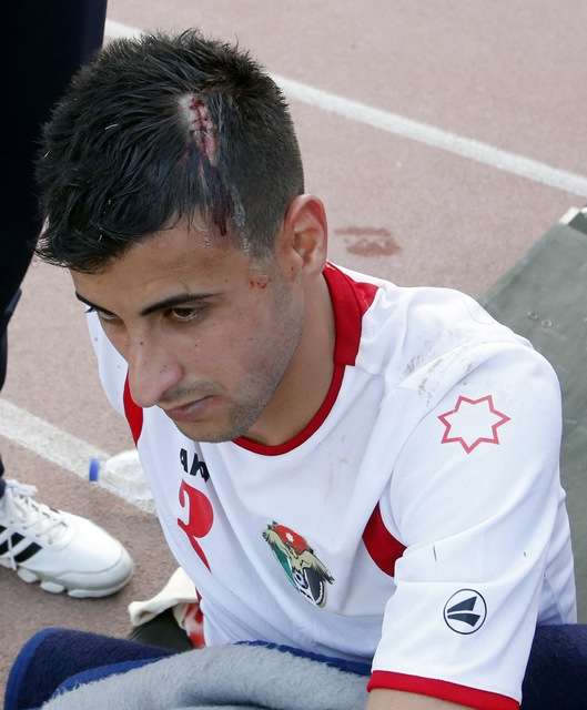 "7" غرز في رأس خطاب (تصوير: أحمد الأمين)