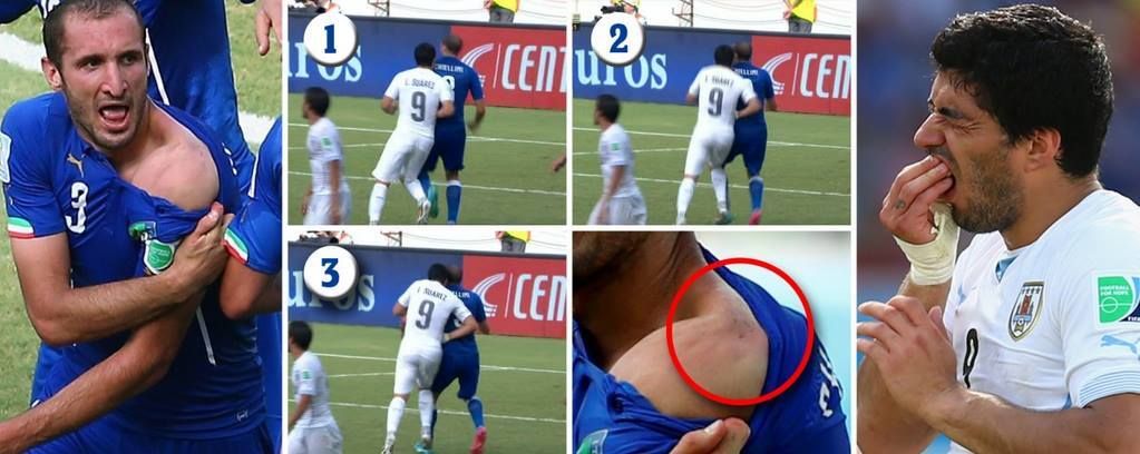 سواريز وعضة كيليني اليوم