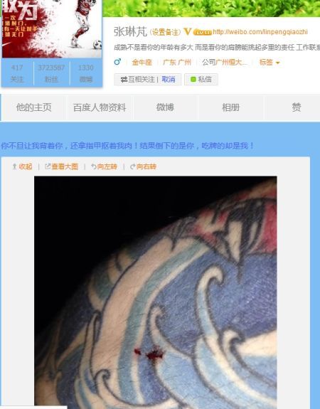 لينبينج يشتكي من تجاهل الحكم لإصابته عبر مدونته