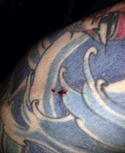 صورة مقربة للجرح الذي أظهره اللاعب في مدونته