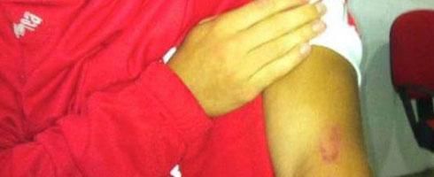 deluca-bari-bite490tw