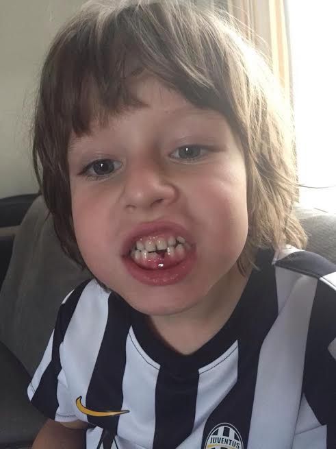 ابن ريجيكامب يفقد أحدى اسنانه