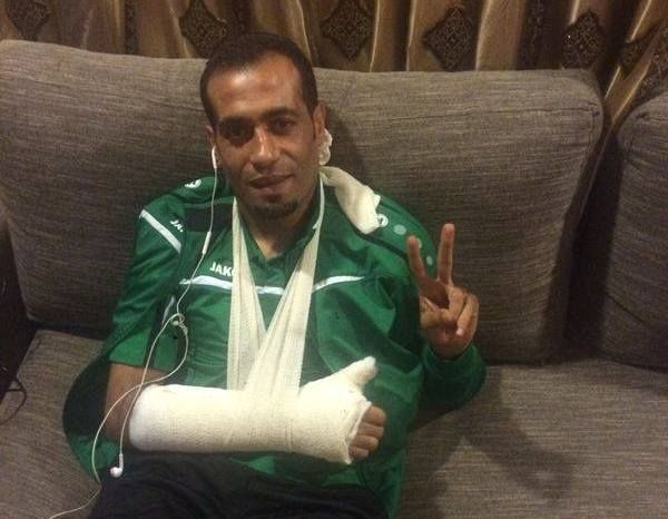 عامر ذيب وضع يده بالجبيرة