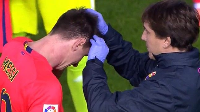 messi-llevo-botellazo-cabeza-1417385312196