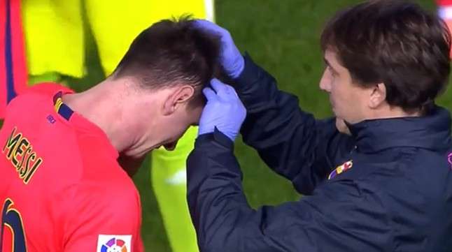 messi-llevo-botellazo-cabeza-1417385312196