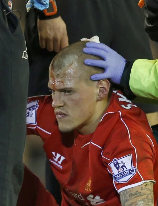 مارتن سكرتل