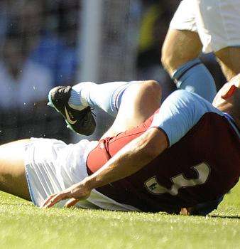 صورة الاصابة ويظهر شكل كسر الكاحل بصورة مؤلمة