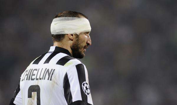 2015-05-05t203227z_73859547_mt1aci13726110_rtrmadp_3_football_reuters