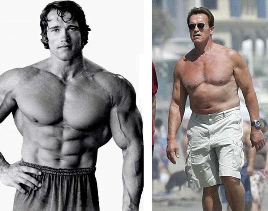 arnold