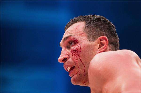 2015-11-29-05046570_epa