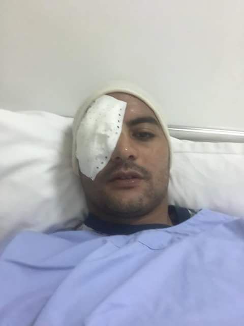عمار الجمل بعد اجراء العملية الجراحية
