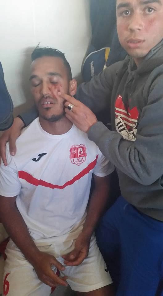 لاعب اتحاد عنابة بلة عماد