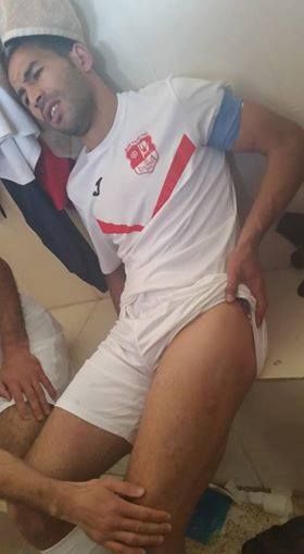 لاعب اتحاد عنابة بولمدايس بلال